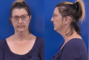 Pennsylvania Woman Charged With Drug Possession After Shopping Center Incident in Prince Frederick