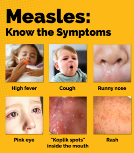 Health Officials Investigating Possible Measles Case; Hospital and First Responders Taking Safety Precautions in St. Mary’s County